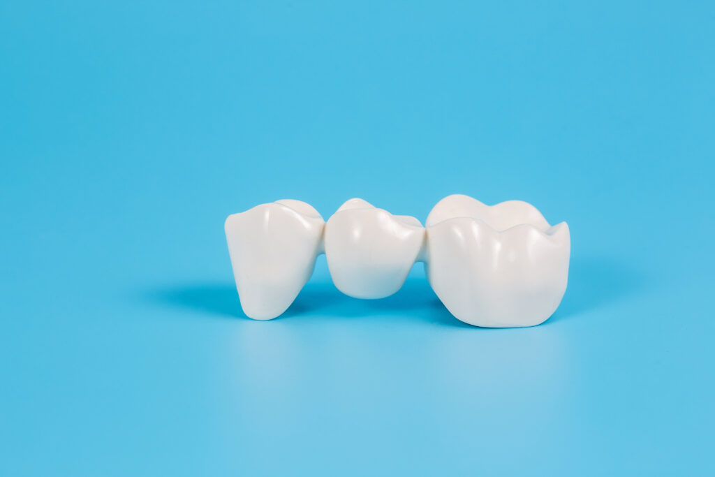 前歯に差し歯ができない場合の治療法は？