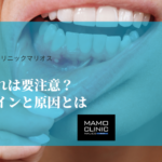 歯ぐきの腫れは要注意？歯周病のサインと原因とは