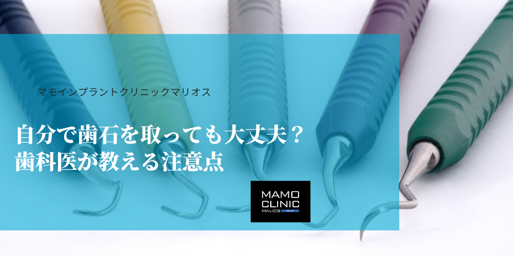 自分で歯石を取っても大丈夫？歯科医が教える注意点