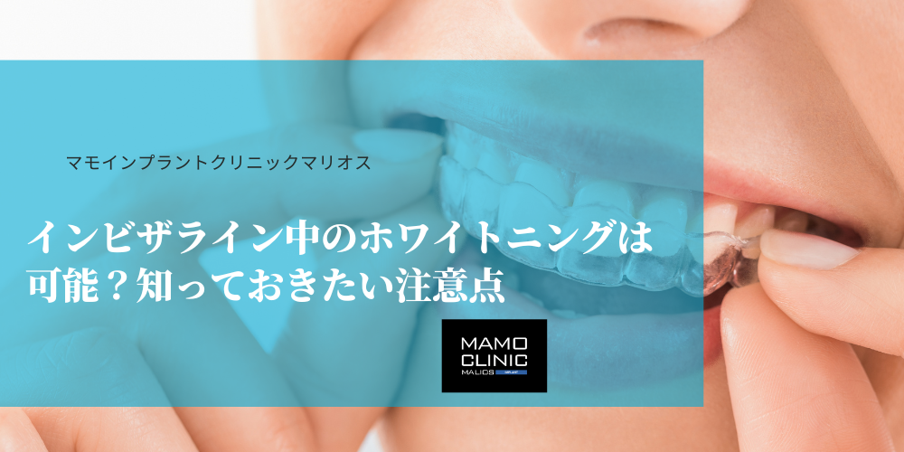 インビザライン中のホワイトニングは可能？知っておきたい注意点