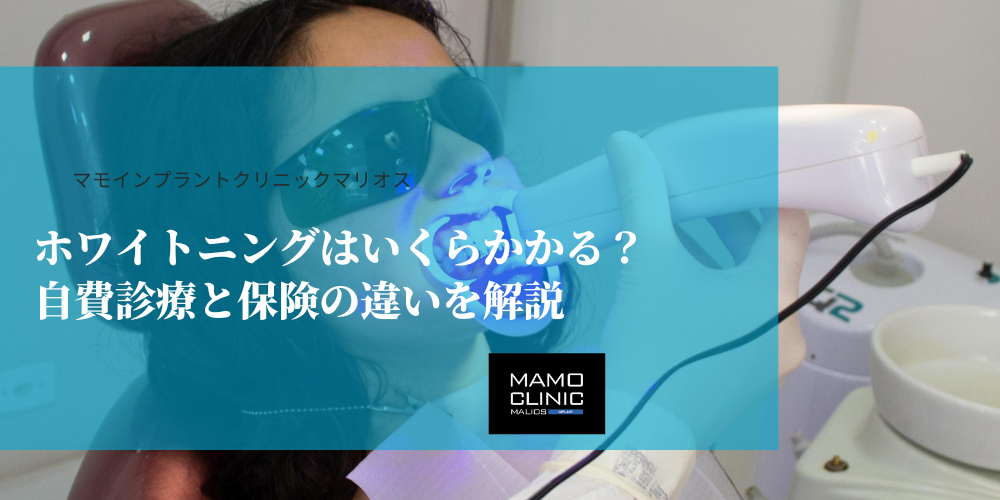 ホワイトニングはいくらかかる？自費診療と保険の違いを解説