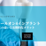 最新技術オールオン4インプラント：従来の入れ歯との違いと長期的なメリット