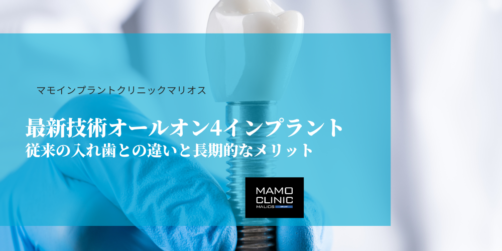 最新技術オールオン4インプラント：従来の入れ歯との違いと長期的なメリット