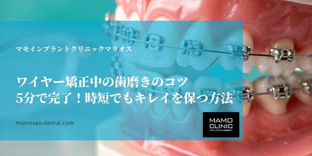 ワイヤー矯正中の歯磨きのコツ｜5分で完了！時短でもキレイを保つ方法