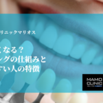 なぜ歯は白くなる？ホワイトニングの仕組みと効果が出やすい人の特徴