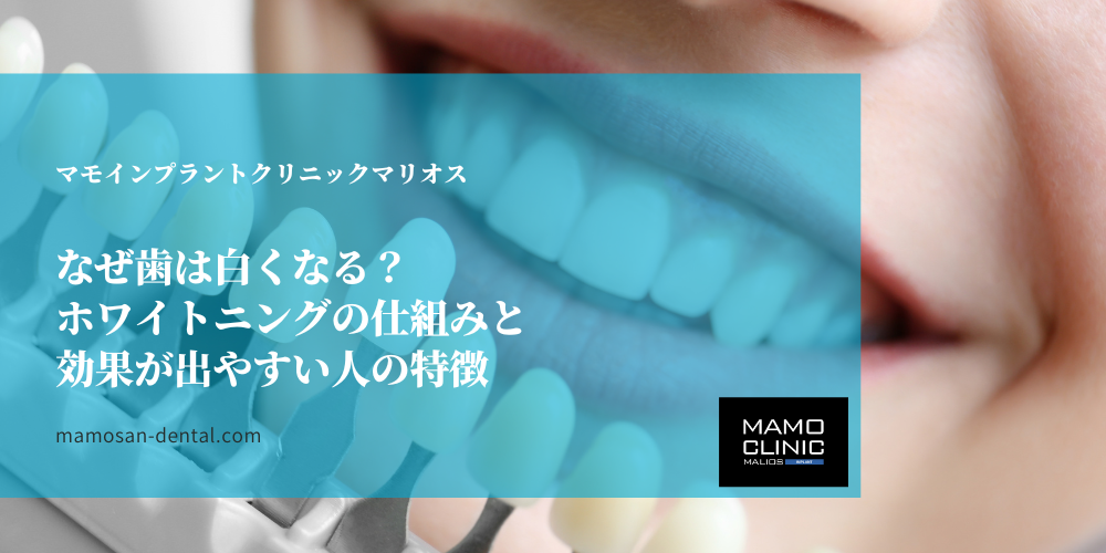 なぜ歯は白くなる？ホワイトニングの仕組みと効果が出やすい人の特徴