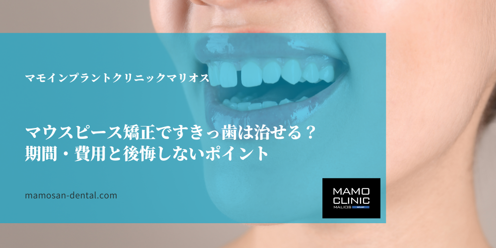 マウスピース矯正ですきっ歯は治せる？期間・費用と後悔しないポイント
