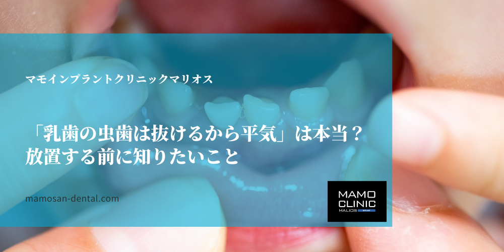 「乳歯の虫歯は抜けるから平気」は本当？放置する前に知りたいこと