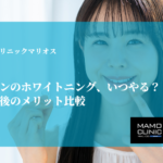 インビザラインのホワイトニング、いつやる？治療前・中・後のメリット比較