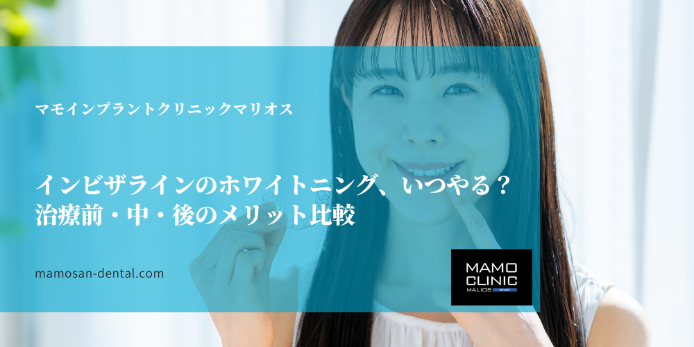 インビザラインのホワイトニング、いつやる？治療前・中・後のメリット比較
