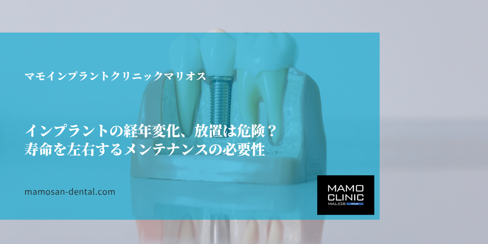インプラントの経年変化、放置は危険？寿命を左右するメンテナンスの必要性