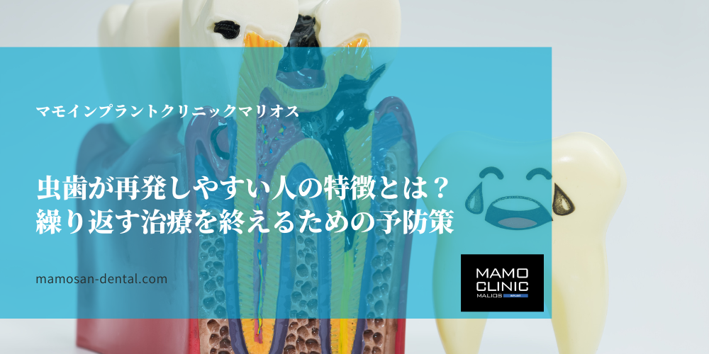 虫歯が再発しやすい人の特徴とは？繰り返す治療を終えるための予防策