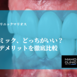 銀歯とセラミック、どっちがいい？メリット・デメリットを徹底比較