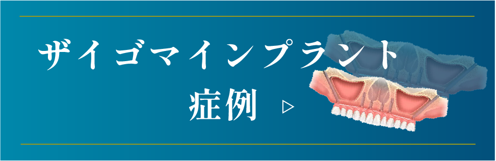 All-on-4インプラント症例はこちら