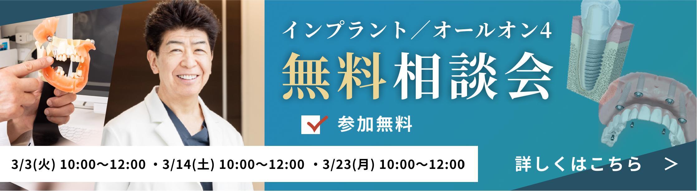 参加無料インプラント講演会開催2/2(月)2/14(土)2/24(火)