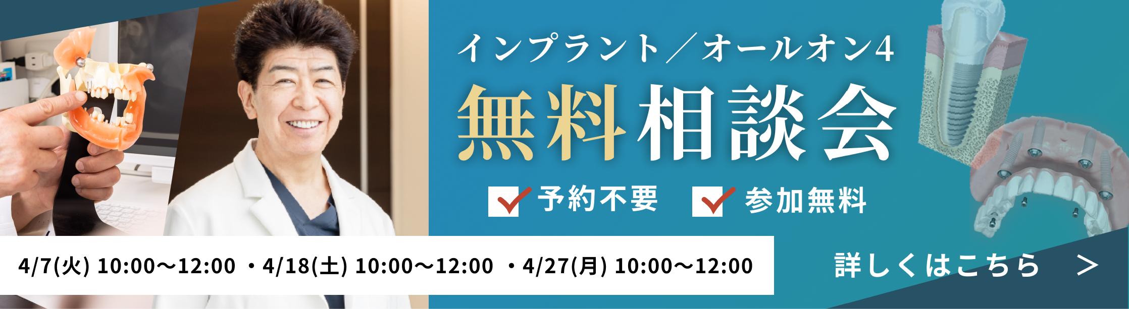 参加無料インプラント講演会開催4/7(火)4/18(土)4/27(月)