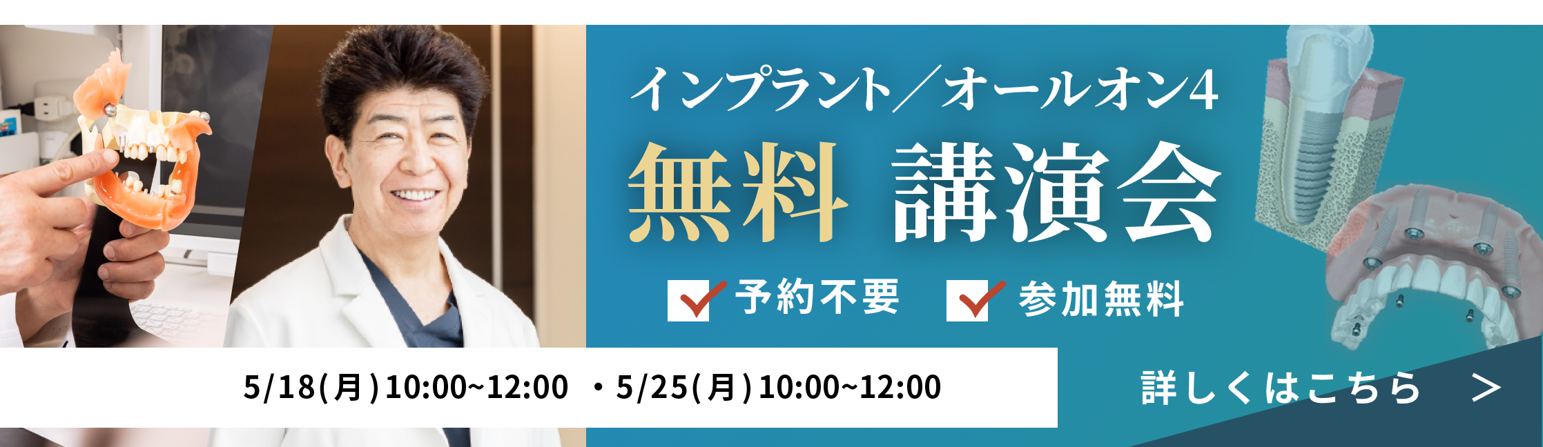 参加無料インプラント講演会開催5/18(月)、5/25(月)