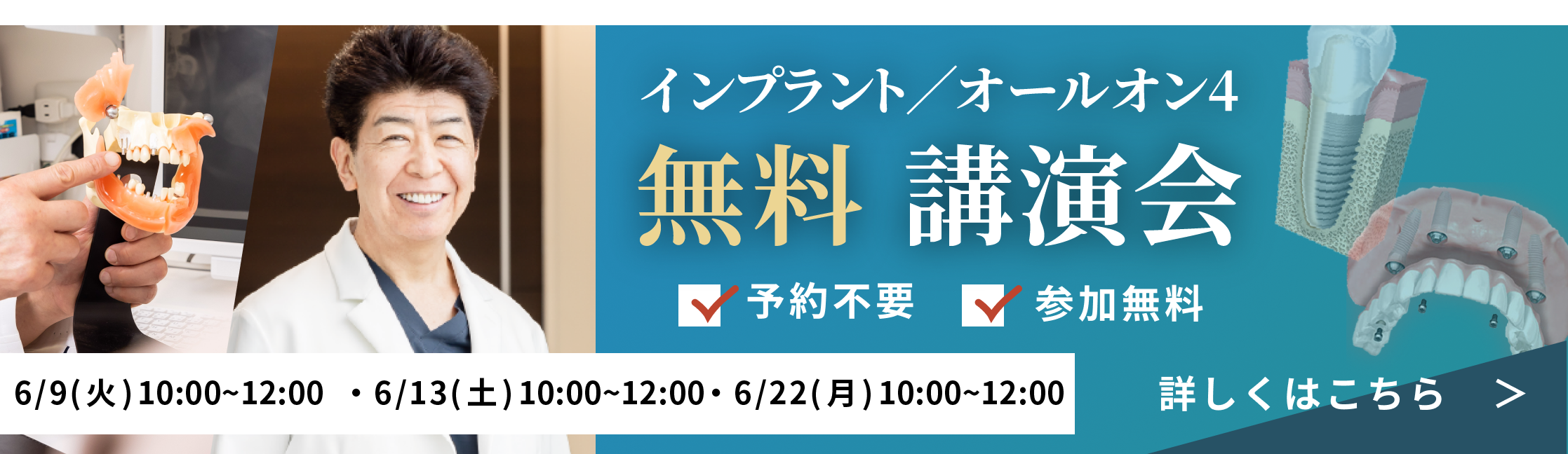 参加無料インプラント講演会開催6/9(火)、6/14(土)、6/22(月)